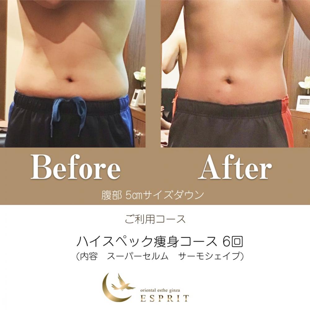 ハンド?マシン?どっちが良いの?実際に痩せた人たちが選んだ痩身コースをご紹介!
