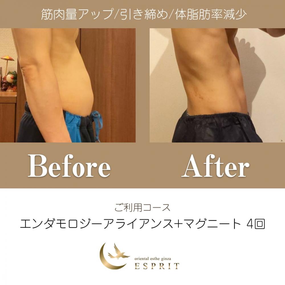 ハンド?マシン?どっちが良いの?実際に痩せた人たちが選んだ痩身コースをご紹介!