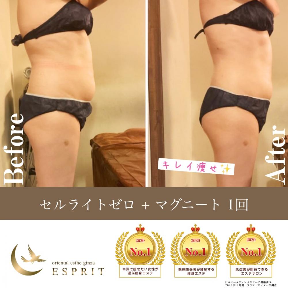 ハンド?マシン?どっちが良いの?実際に痩せた人たちが選んだ痩身コースをご紹介!