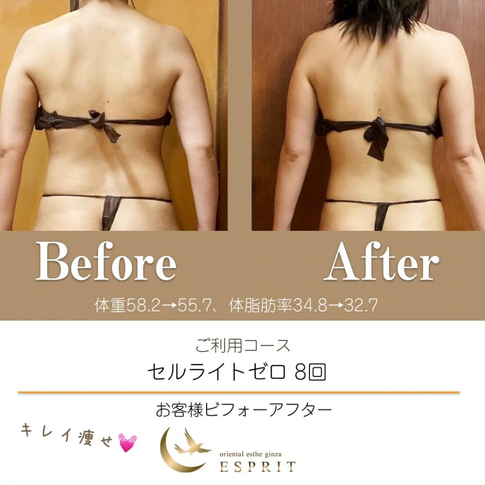ハンド?マシン?どっちが良いの?実際に痩せた人たちが選んだ痩身コースをご紹介!