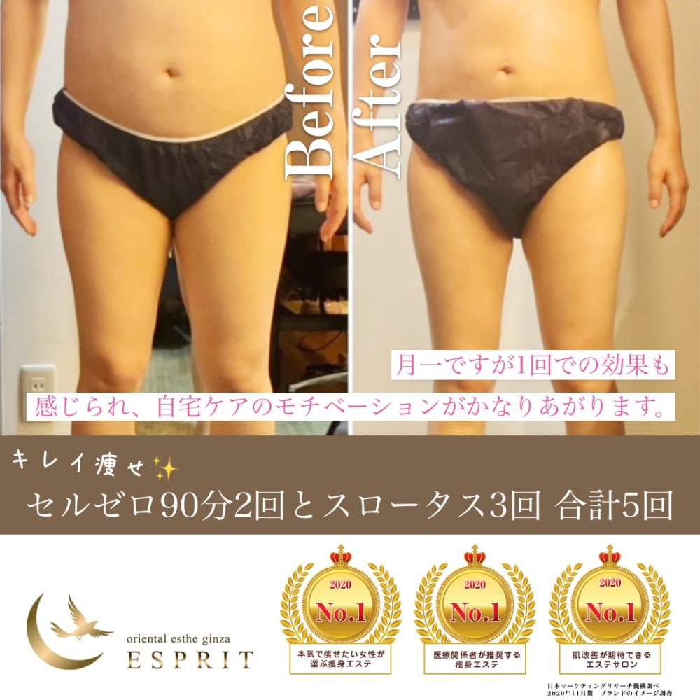 ハンド?マシン?どっちが良いの?実際に痩せた人たちが選んだ痩身コースをご紹介!