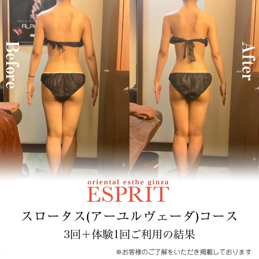 夏目前!気になるお腹・太もももスッキリ!今始める痩身エステ!