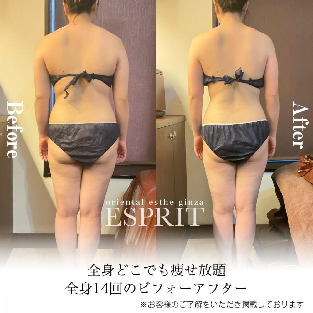 夏目前!気になるお腹・太もももスッキリ!今始める痩身エステ!