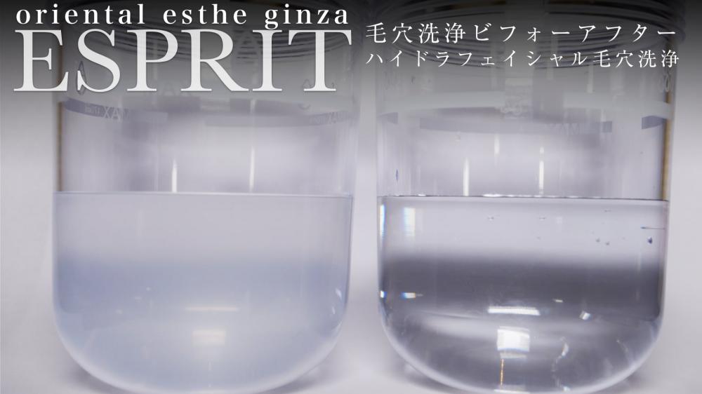 毛穴の汚れ・ニキビでお悩みなら「ハイドラフェイシャル」♪♪