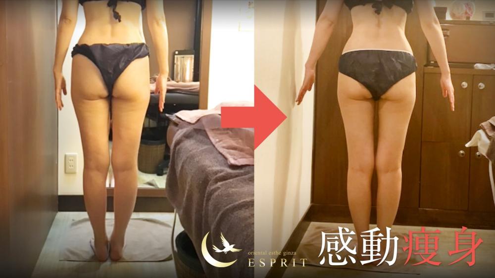 ～医療から美容へ～安全で結果の出るメディカル痩身登場!