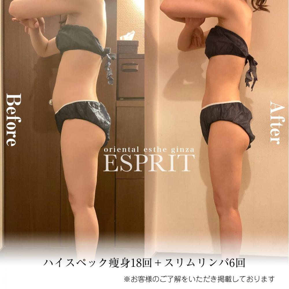 2024年4月痩身&肌改善(肌管理)エステコースのビフォーアフターをご紹介!