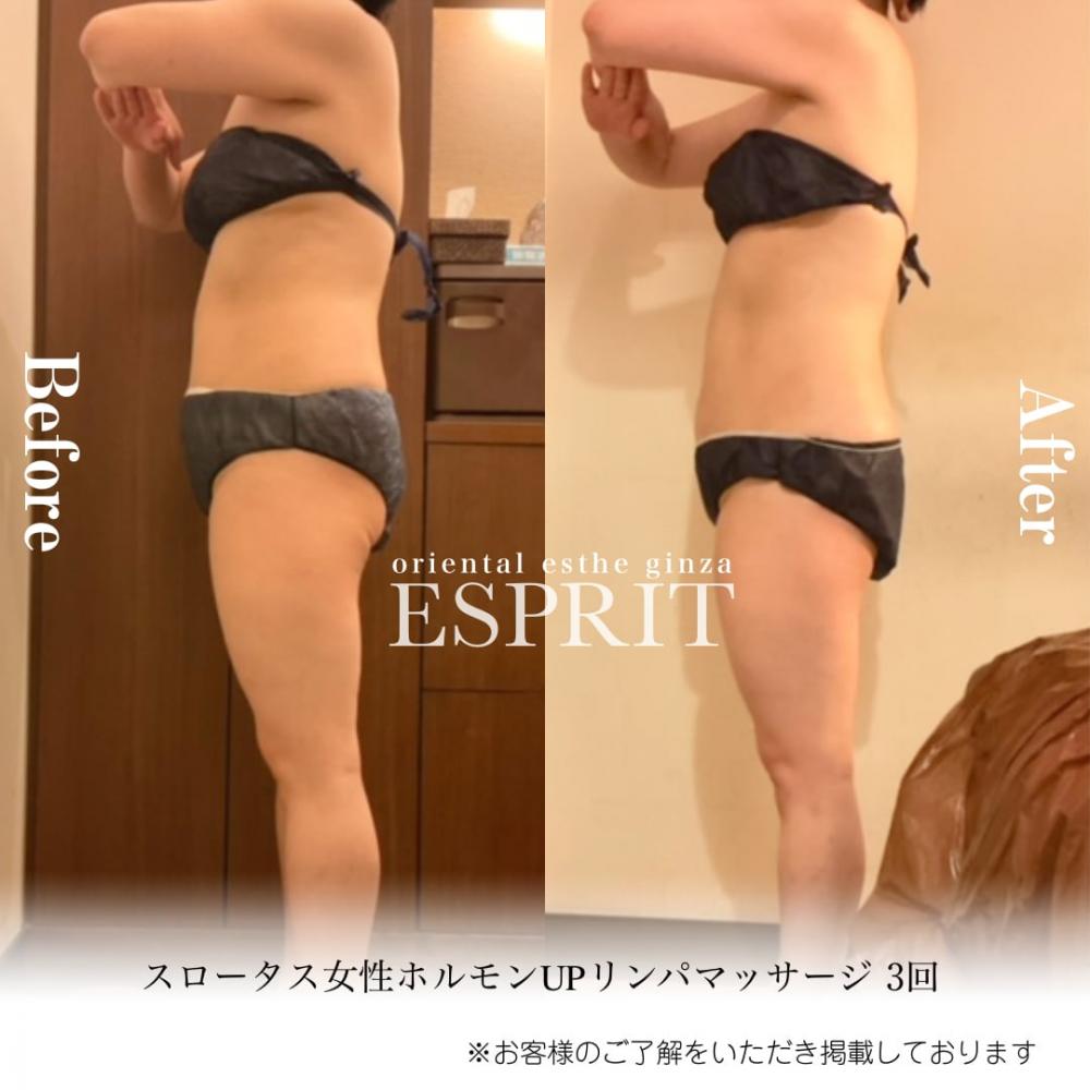 2024年4月痩身&肌改善(肌管理)エステコースのビフォーアフターをご紹介!