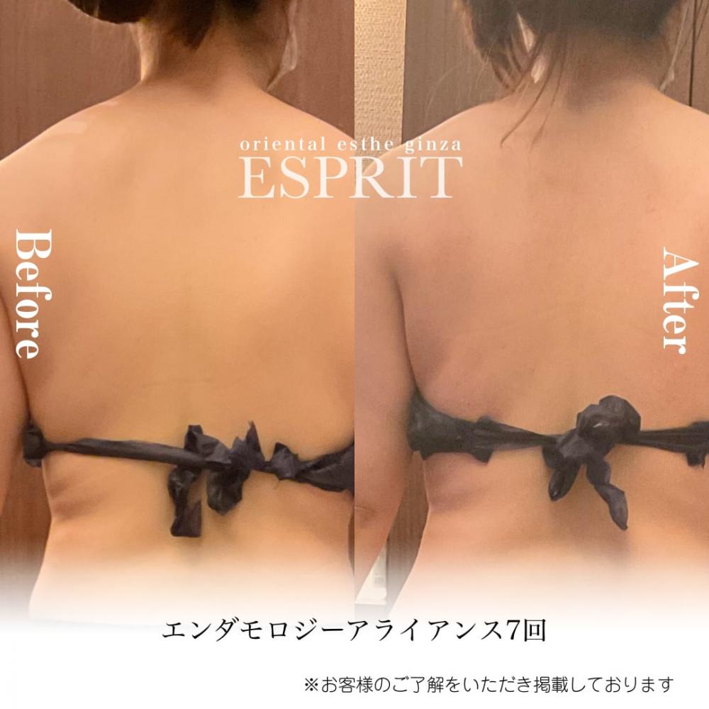 2024年4月痩身&肌改善(肌管理)エステコースのビフォーアフターをご紹介!