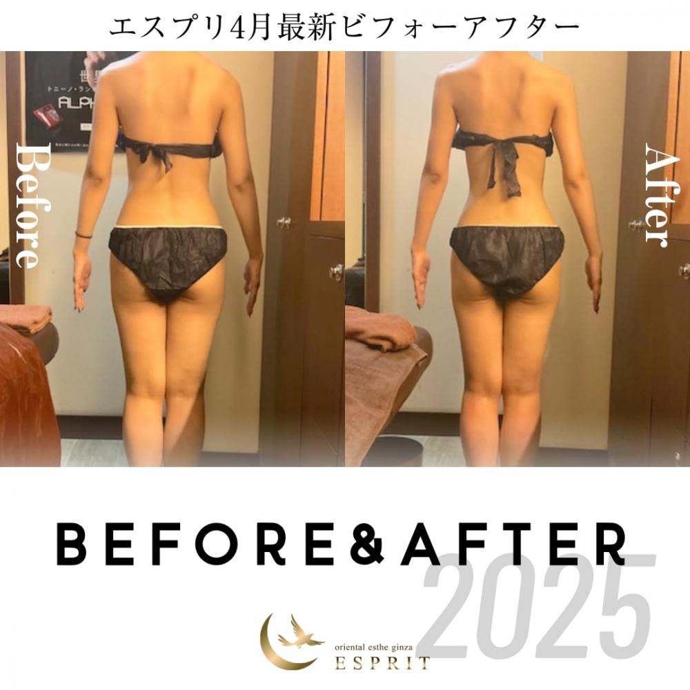 銀座・新宿エスプリ【2025年4月の痩身＆肌改善エステ】ビフォーアフター事例４選