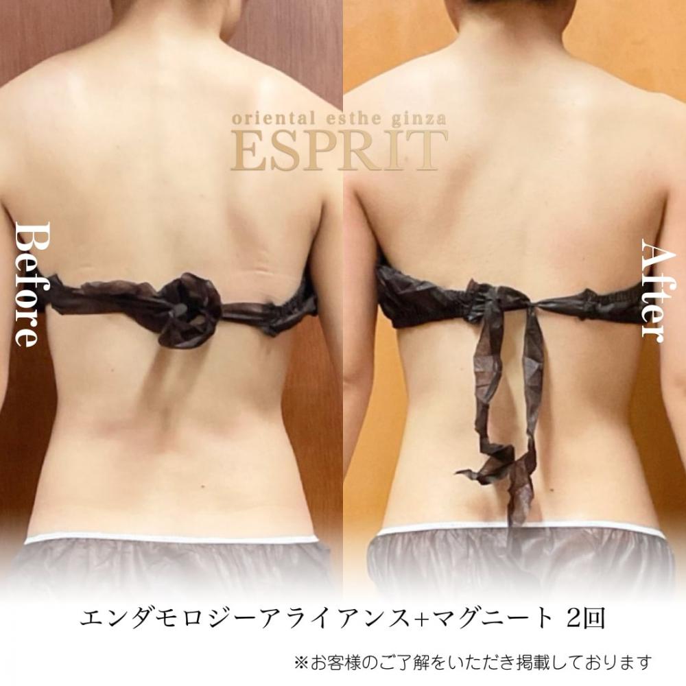 2024年5月痩身&肌改善(肌管理)エステコースのビフォーアフターをご紹介!