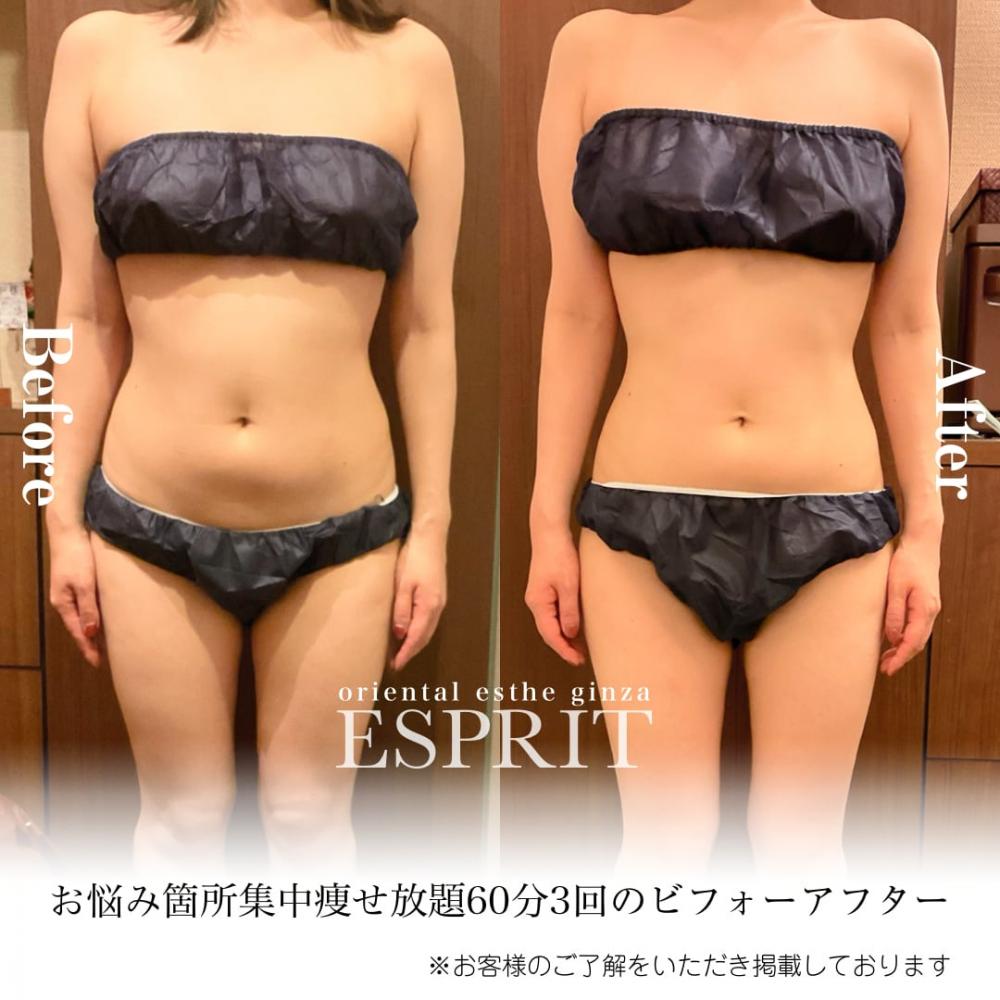 ぽっこりお腹が平らになりました!