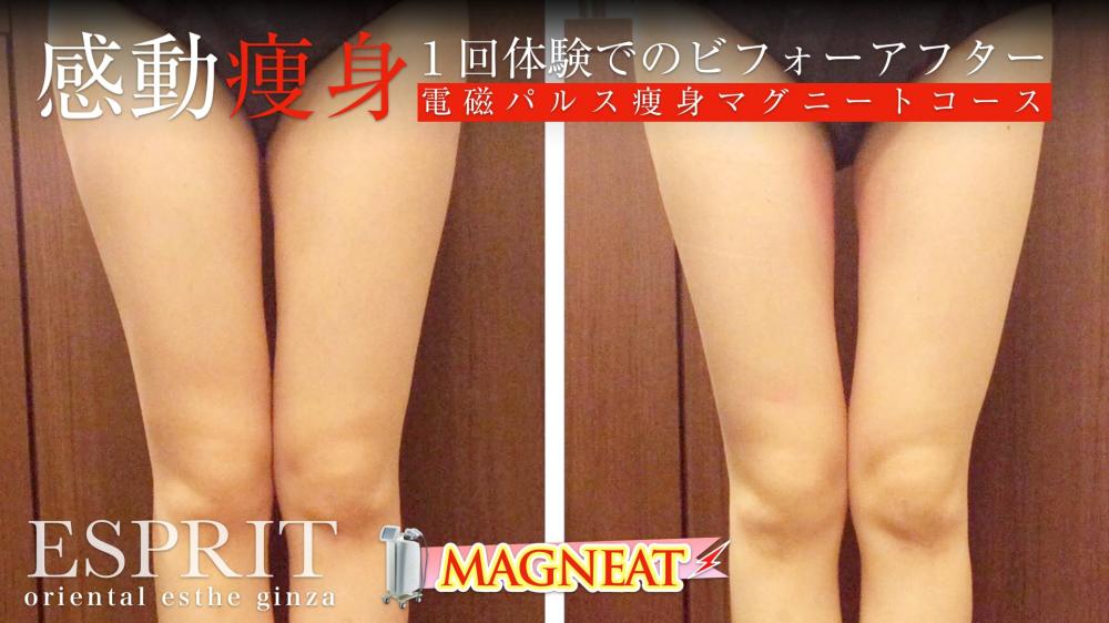 寝ているだけで筋肉を鍛えながら脂肪を燃やす!引き締まったメリハリボディに電磁パルス痩身マグニート