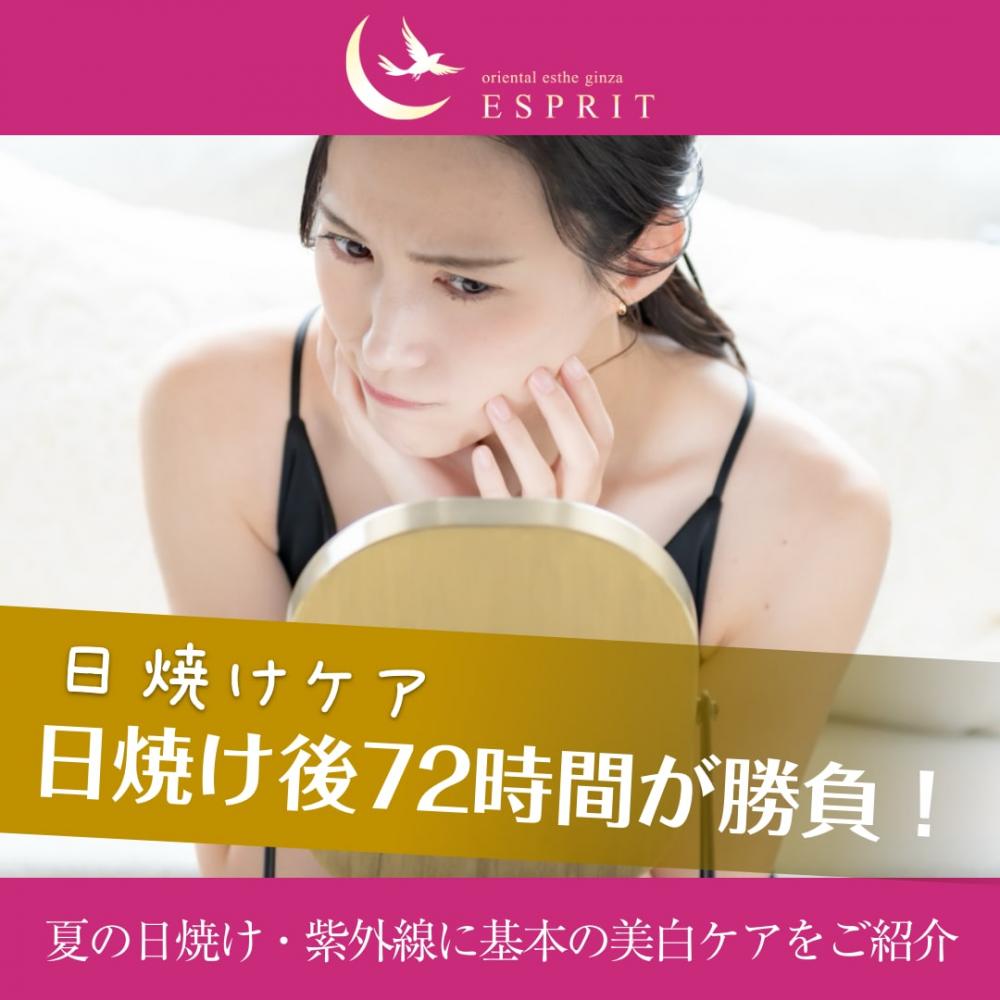 日焼け後72時間が勝負！夏の日焼け・紫外線に基本の美白ケアをご紹介！