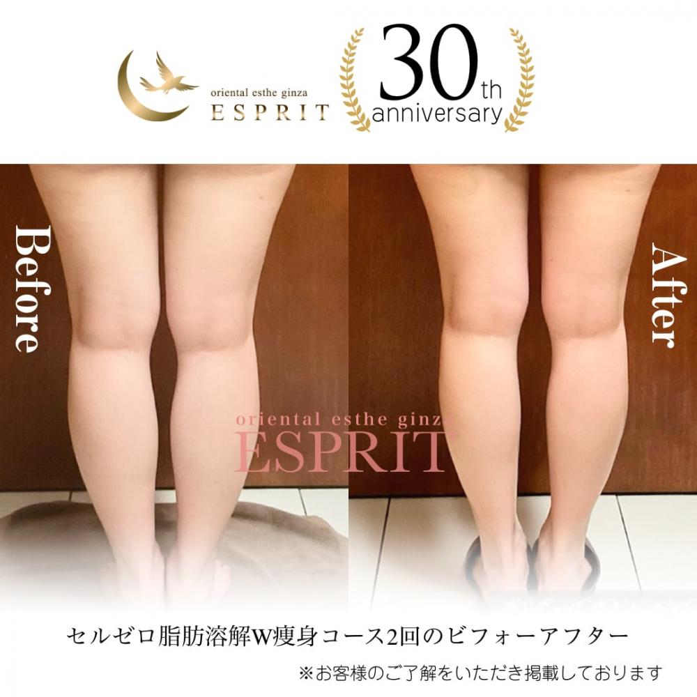 自分の足ではないみたいにすっきりと軽くなりました