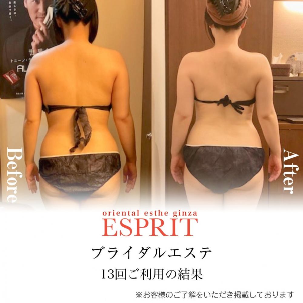 【2025年6月の痩身&肌改善エステ】ビフォーアフター