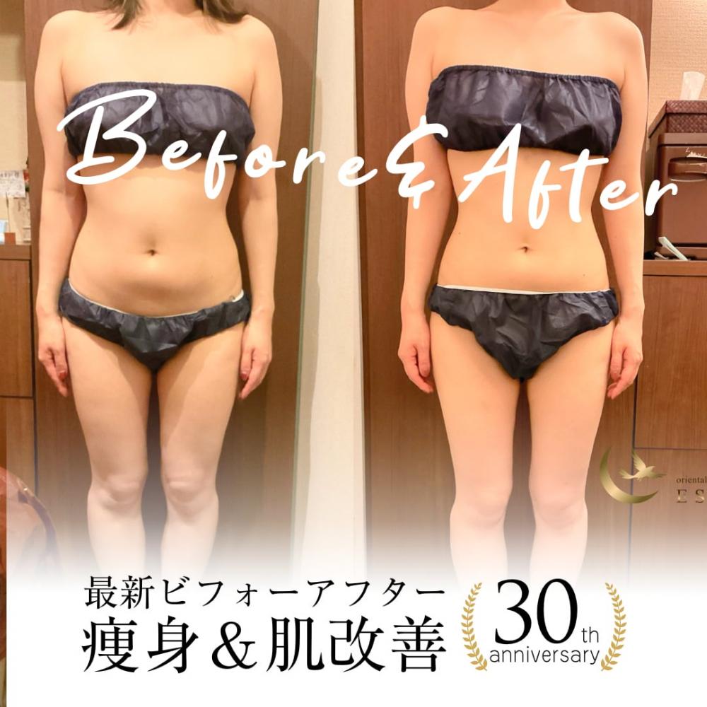 2024年7月痩身&肌改善(肌管理)エステコースのビフォーアフターをご紹介!