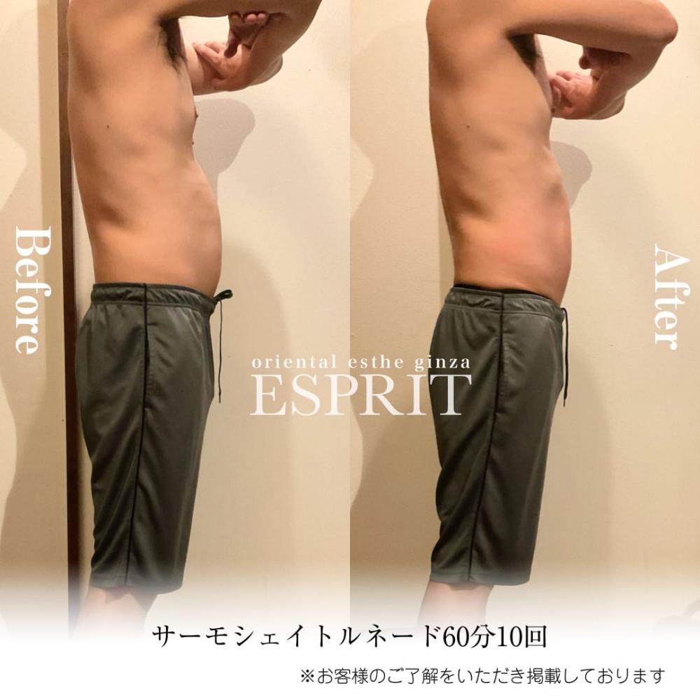 2024年7月痩身&肌改善(肌管理)エステコースのビフォーアフターをご紹介!