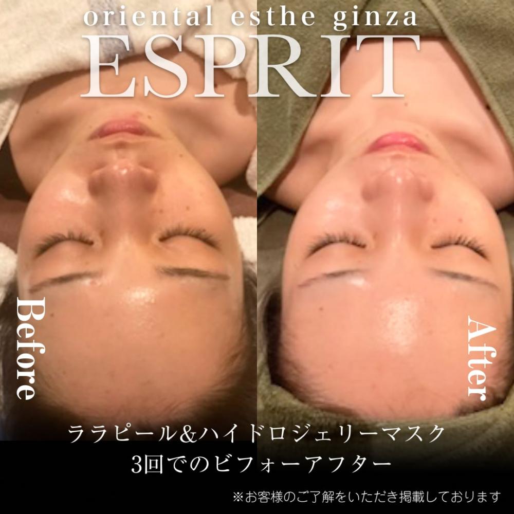 2024年7月痩身&肌改善(肌管理)エステコースのビフォーアフターをご紹介!