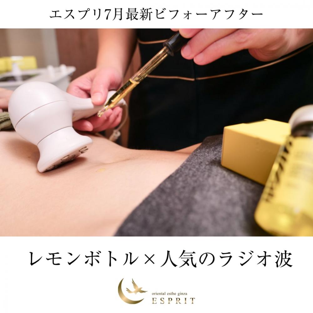 東京で話題!【レモンボトル×人気のラジオ波】2025年7月痩身エステのビフォーアフター事例5選