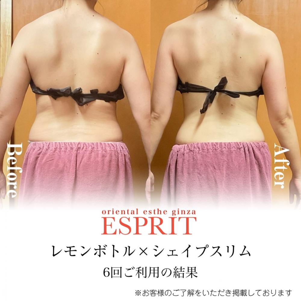 花嫁必見!最短2回から実感「レモンボトル」でブライダルエステ!フェイスライン&背中すっきり