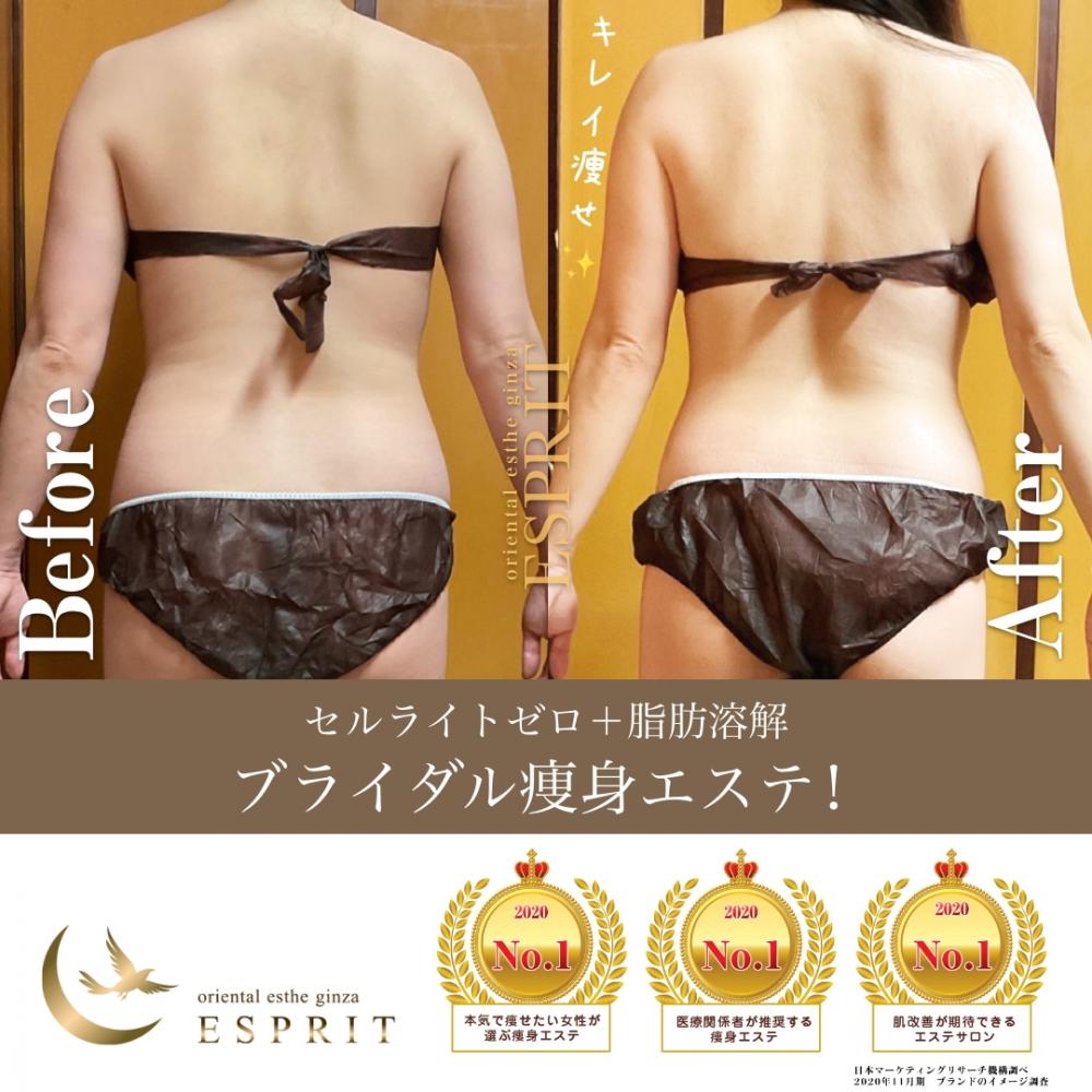 ブライダルエステに嬉しい新メニュー!「欲張り花嫁♡選べるメニュー体験し放題コース」をご紹介します