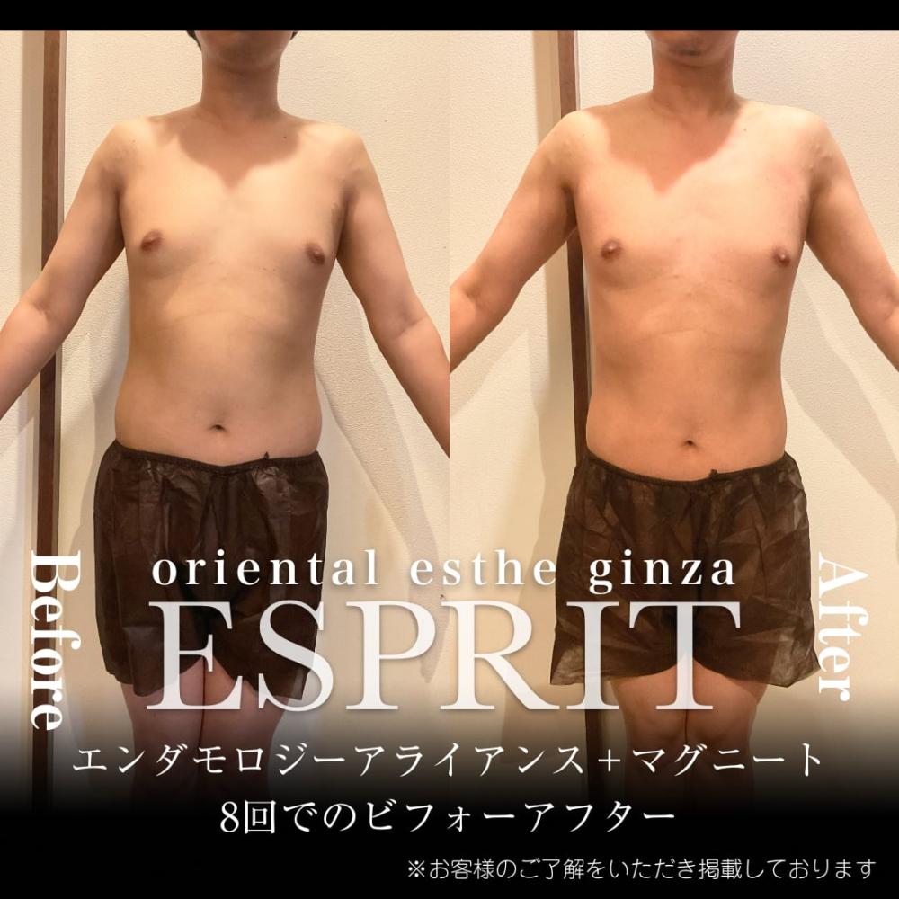 2024年8月痩身&肌改善(肌管理)エステコースのビフォーアフターをご紹介!