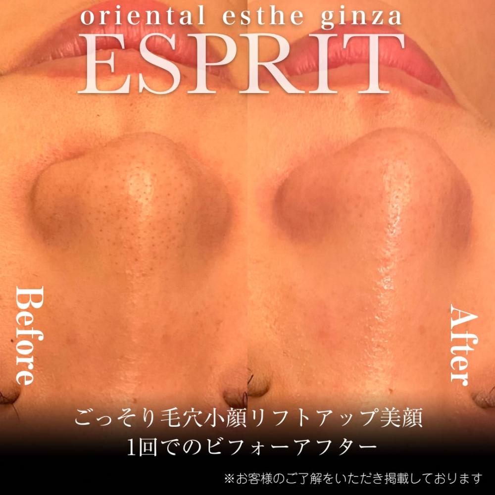 2024年8月痩身&肌改善(肌管理)エステコースのビフォーアフターをご紹介!